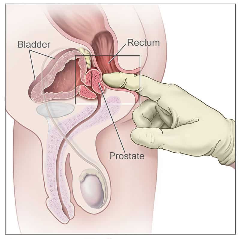 prostate-massage-anatomic